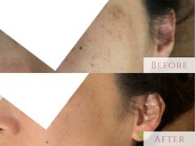 フルール 香椎駅前店(fleur)