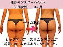 ファニービー 高槻店/症例写真