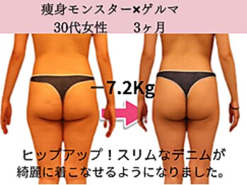 ファニービー 高槻店/症例写真