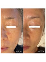 成宮鍼灸整骨院