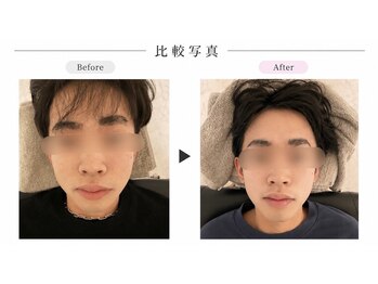 リラボ整体院 赤坂店(RE+LAB=◯整体院)/ビフォーアフター歪み
