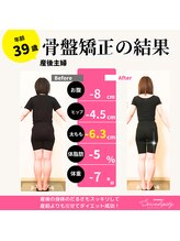 セレンディピティ 守山店(Serendipity)/39歳　産後骨盤、ダイエット