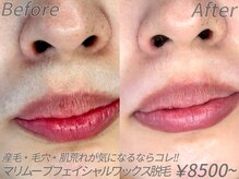 ゼンアイズ(Zen eye's)の雰囲気（ワックス脱毛で産毛・汚れをしっかりキャッチ◎素肌に自信を♪）