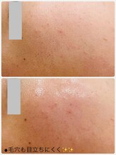 プチ プロムナード(Petit Promenade)/美肌フェイスワックス