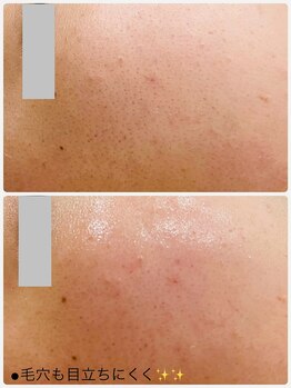 プチ プロムナード(Petit Promenade)/美肌フェイスワックス