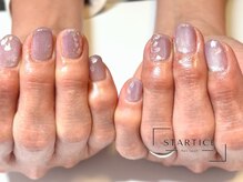 スターチス(STARTICE)/定額シンプルコース