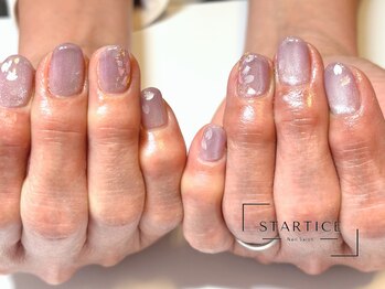 スターチス(STARTICE)/定額シンプルコース