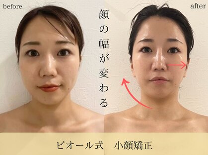 ビオール 池袋店(beall)の写真