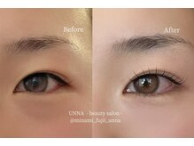 ウナ(UNNA)/パーマ Before/After