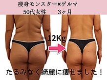 ファニービー 高槻店/症例写真