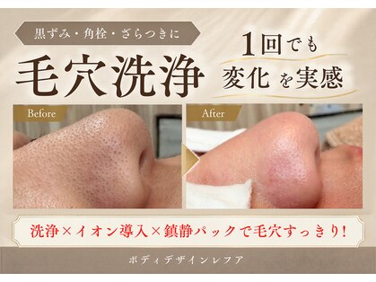 レフアの写真