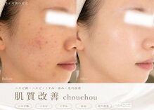 シュシュ 岸和田(chouchou)