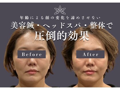 カロン(KALON)の写真