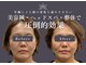 カロン(KALON)の写真