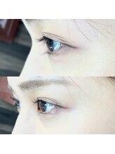 アーリ 高槻店(ALI)/ビフォーアフター写真