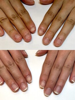 マリーロール 梅田店(Marie Laure)/自爪育成/深爪矯正/ネイルケア