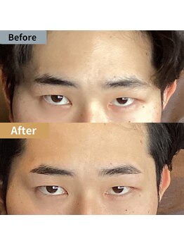 眉毛ハウス 吉祥寺店(眉毛HOUSE)/お客様の施術例(吉祥寺/東京)