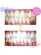 エクシア 伊勢店 サロンルナ/ビフォーアフター