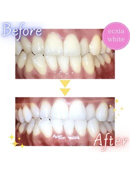 エクシア 伊勢店 サロンルナ/ビフォーアフター