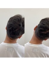 ランドル(rendre)/５０代男性　首を動きで肩が痛い