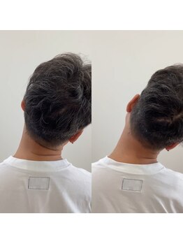 ランドル(rendre)/５０代男性　首を動きで肩が痛い