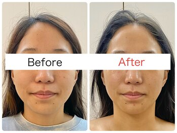 ウニカ(Unica)/ブライダル☆プレ花嫁様