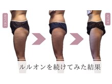 ヨサパーク メープル 池尻大橋店(YOSA PARK MAPLe)の雰囲気（リバウンド卒業！ストレスfree！食事・運動・努力なし！が魅力的）