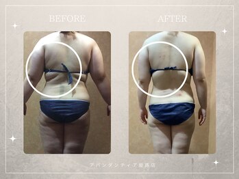 アバンダンティア 姫路店/後ろ姿がこんなに変化!!