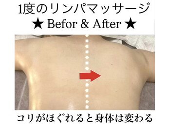 リラクゼーションサロン アイリス(IRIS)/リンパマッサージ