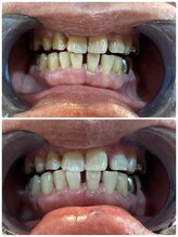 【医療提携】ホワイトニング専門店～Cinderella～/