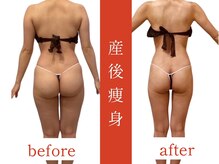 ウィズルーチェ 麻布十番店(with luce)/３０代　産後　痩身