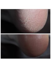 キコ ネイル(KICO nail)