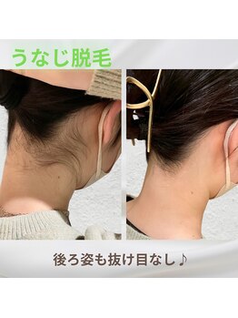 ヴィ シェーン(Vi Schoen)の写真/うなじ脱毛も◎あなたに寄り添う丁寧な接客で自信あふれる毎日に☆