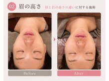 モアフェイス 池袋店(More Face)/小顔矯正　左右差矯正　眉の高さ