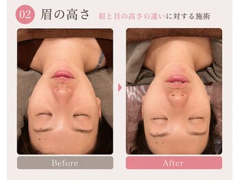 モアフェイス 池袋店(More Face)/小顔矯正　左右差矯正　眉の高さ