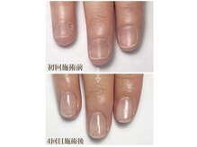 ラピスネイル(Lapis Nail)の雰囲気(美爪育成コース(クリア)¥8800)