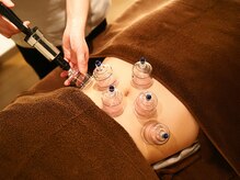 りっつ鍼灸院/お腹もスッキリ！カッピング