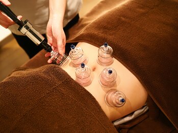 りっつ鍼灸院/お腹もスッキリ！カッピング