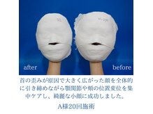 ふらっとエステ