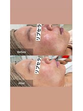 サロン ウイ(salon u'i)/～リブセラ～