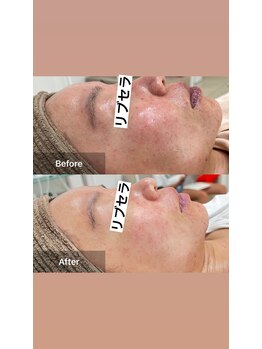 サロン ウイ(salon u'i)/~リブセラ~