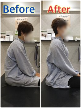 くすの樹接骨院 整体院 吉野ヶ里院/整体/骨盤矯正ビフォーアフター