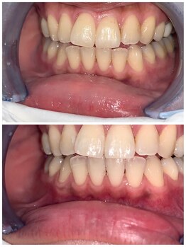 ライトビューティー 池袋店(LightBeauty)/症例写真