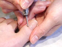 ネイルケアタイム メディカルセンター川越店(NAIL CARE TiME)/フット【爪周りの角質ケア】