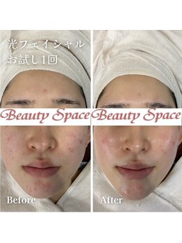 ビューティースペース 松戸店/