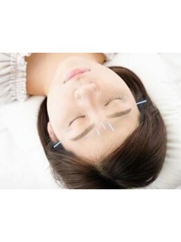 小顔になりたい