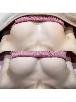 エヌエー(na)/バストアップ特許技術