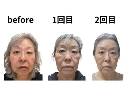 凛の写真