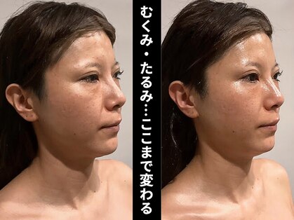 グレースフィオーレ 南越谷店(gracefiore)の写真