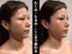 グレースフィオーレ 南越谷店(gracefiore)の写真
